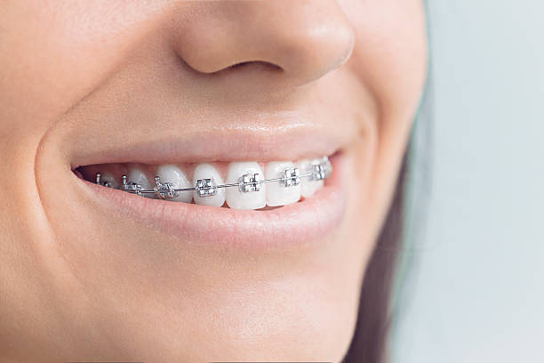 Best Wisdom Tooth Removal  in Loves Park, IL